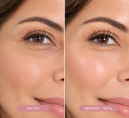 Antes y después del bálsamo facial K-Beauty mostrando reducción visible de líneas de expresión en contorno de ojos - Andelika Shop